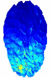 Image Based Mesh Generation for Realistic Simulation of the Transcranial ...