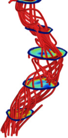 Using Optical Flow Tracing of MRI Flow Artifacts to Validate CFD Findings