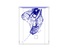 Particle Tracing: Analysis of Airborne Infection Risks in Operating Theatres