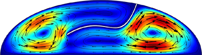 Fluid Flow During Descemet Membrane Detachment