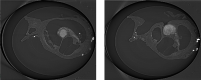A 3D Simulation of the Diffusion Profile of Brain Derived Neurotrophic ...