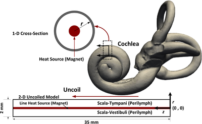 A Heat Transfer Analysis of the Cochlea During Magnetically-guided Cochlear ...