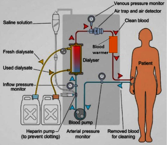 Design of Blood Warmer Medical Device