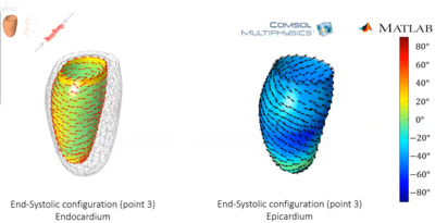 Patient-specific Analysis of Left Ventricle Motion