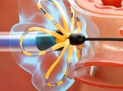Democratizing In Silico Ablation R&D with IN SILICO STEM