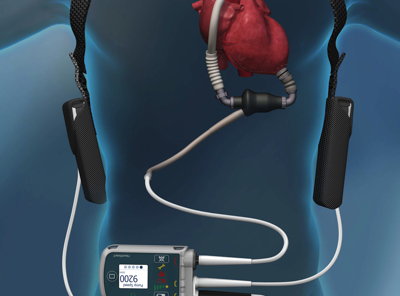 Enhancing Performance and Safety of Medical Implantable Devices with ...