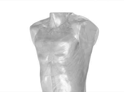 MicroPort CRM Optimizes Leadless Cardiac Pacemaker Communication 